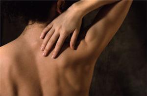 Physiotherapists to offer new treatment for rare condition