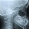 Radiography perceived by...