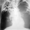 New radiography equipment...