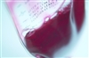 Phlebotomy services 'will be...