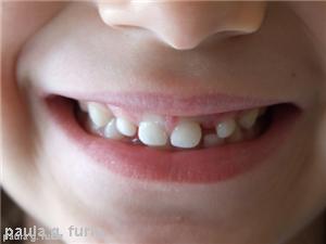 New programme to help promote speech therapy