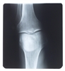 Diet 'plays key role in bone...