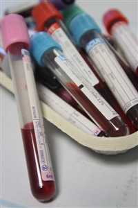 New campaign for Hep B and C tests in pharmacies