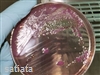 E Coli 'could have long term...
