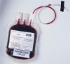 Blood stocks dropping due to...