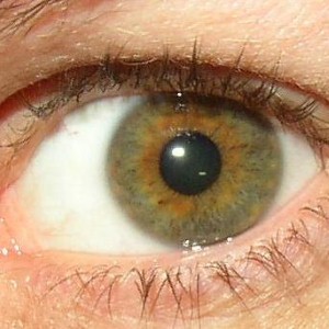 Mediplacements - Diet 'key' to avoiding degenerative eye conditions