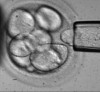 Stem cells to restore...