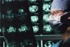 Traumatic brain injury 'linked...