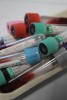 Biochip technology can assess...