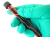 Two new blood types discovered