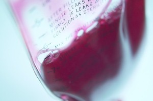 Lower blood flow to the brain potentially linked to cardiac problems