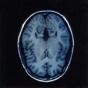 Image: Lancet