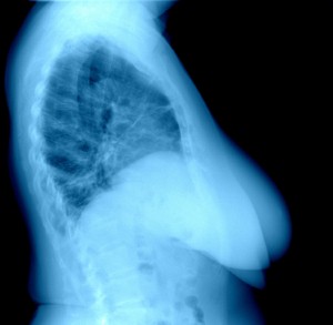 Phase-contrast X-ray imaging could help to improve outcomes for breast cancer patients. Image: kalus via iStock