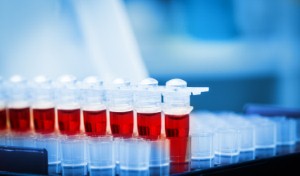 A new blood test may lead to improved treatment options for patients with psychosis, according to new research. Image: luchschen via iStock