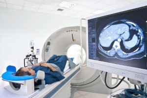 Researchers have developed a cardiac functional MRI scan that is non-invasive to patients.